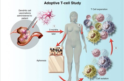 illustration of adoptive t cell study
